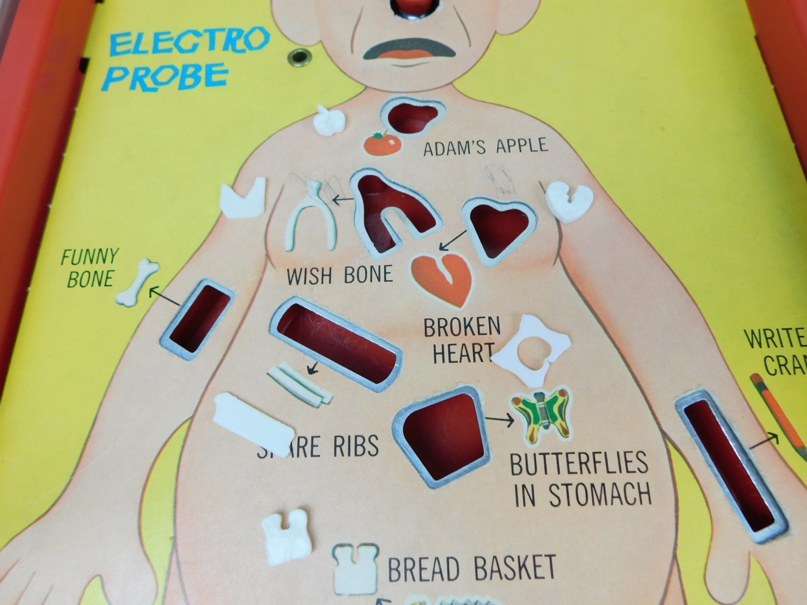 1965 OPERATION Original Electronic Vintage Game Toy Milton Bradley – no power