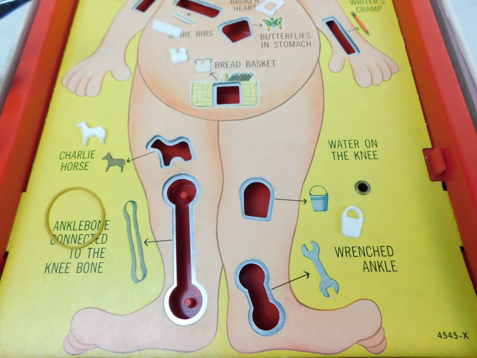 1965 OPERATION Original Electronic Vintage Game Toy Milton Bradley – no power