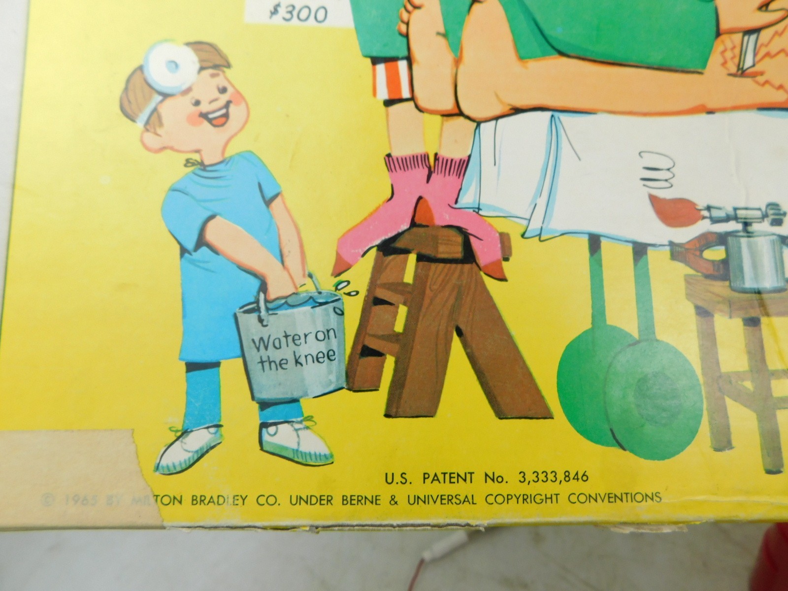 1965 OPERATION Original Electronic Vintage Game Toy Milton Bradley – no power